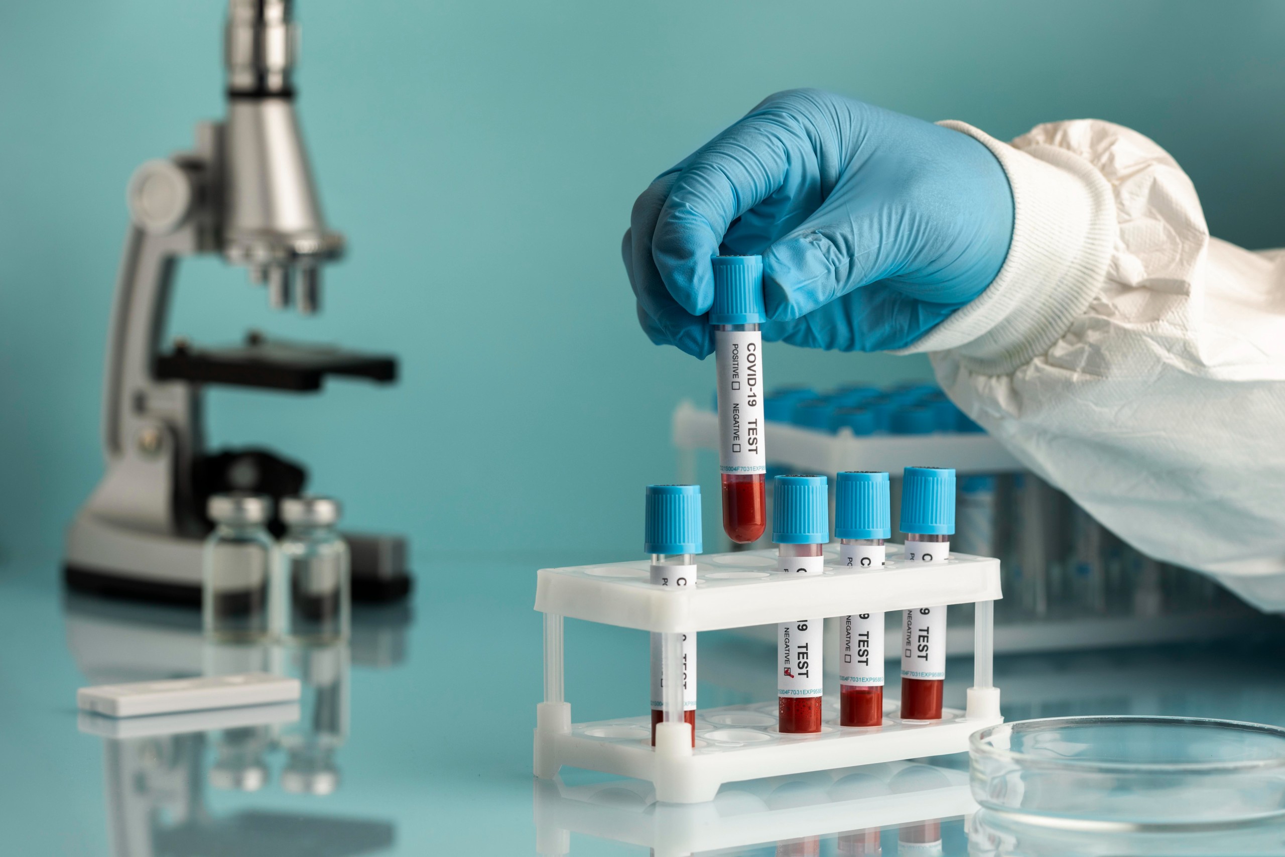 hand-with-protective-gloves-holding-blood-samples-covid-test (1)